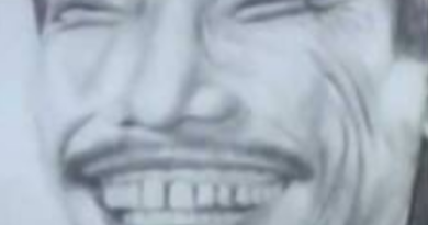 Teeth